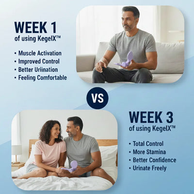 KegelX™| Men's Pelvic Floor Trainer